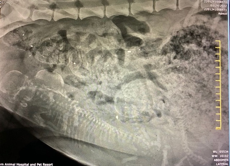 an x-ray of a person's stomach