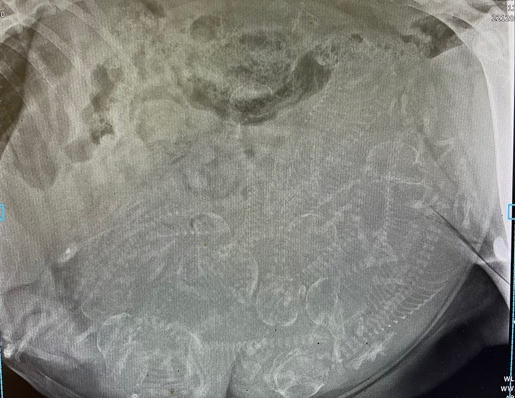 a close up of a chest x-ray